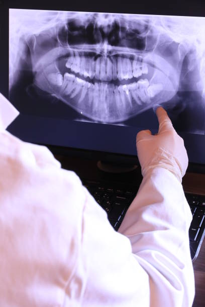 Best Emergency Tooth Extraction in Wagener, SC