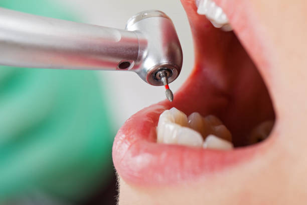 Best Walk-In Emergency Dentist in Wagener, SC